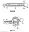 Fig. 09 - Apparatus and methods for treating stroke and controlling cerebral flow characteristics