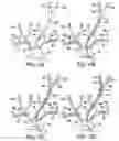 Fig. 16 - Apparatus and methods for treating stroke and controlling cerebral flow characteristics