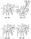 Fig. 17 - Apparatus and methods for treating stroke and controlling cerebral flow characteristics