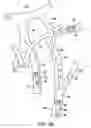 Fig. 20 - Apparatus and methods for treating stroke and controlling cerebral flow characteristics