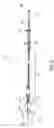 Fig. 07 - Flexible polymer needle catheter