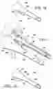 Fig. 09 - Suction sleeve and interventional devices having such a suction sleeve