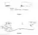 Fig. 04 - Methods and apparatus for placing intradiscal devices