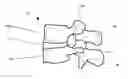 Fig. 01 - Facet fusion system