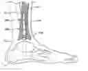 Fig. 01 - Intramedullary guidance systems and methods for installing ankle replacement prostheses