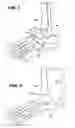 Fig. 02 - Intramedullary guidance systems and methods for installing ankle replacement prostheses