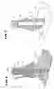 Fig. 06 - Intramedullary guidance systems and methods for installing ankle replacement prostheses