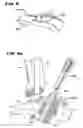Fig. 08 - Intramedullary guidance systems and methods for installing ankle replacement prostheses