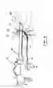 Fig. 03 - Device for sealing a cervical canal