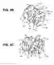 Fig. 08 - Hair removal system