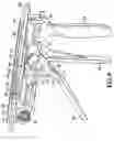 Fig. 06 - Flexible surgical clip applier