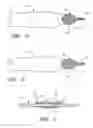 Fig. 04 - Safety surgical forceps