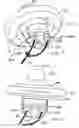 Fig. 09 - Blood vessel occlusion device