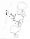 Fig. 09 - Active suture for the delivery of therapeutic fluids