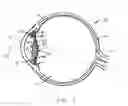 Fig. 02 - Ocular lens