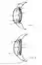 Fig. 04 - Ocular lens