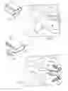 Fig. 02 - Dynamic intervertebral implant