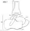 Fig. 02 - Ankle replacement system