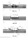 Fig. 02 - Viable tissue repair implants and methods of use