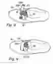 Fig. 04 - Lace trapping device
