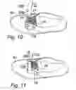 Fig. 05 - Lace trapping device