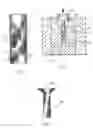 Fig. 02 - Method for making a fiber reinforced composite rivet having an upset head
