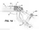 Fig. 22 - Shaving systems