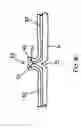 Fig. 08 - Method for forming footwear structures using thermoforming