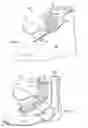 Fig. 02 - Shoe support system