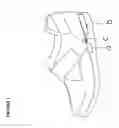 Fig. 02 - Therapeutic vibrating shoe