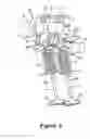 Fig. 09 - Valve train device for an engine