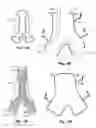Fig. 02 - Protecting biological structures, including the great vessels, particularly during spinal surgery