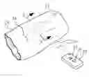 Fig. 01 - Tissue expander, system and method