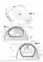 Fig. 02 - Tissue expander, system and method