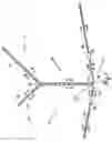 Fig. 02 - Peritoneal dialysis catheter