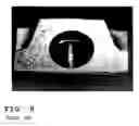 Fig. 09 - Connecting rod split construction
