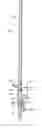 Fig. 01 - Weed extraction tool