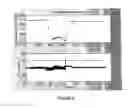 Fig. 09 - Automatic reserve or primary parachute activation device