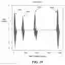 Fig. 26 - Auto focus for a flow imaging system