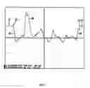 Fig. 06 - Reflective optical sensor for bill validator