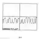 Fig. 07 - Reflective optical sensor for bill validator