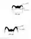 Fig. 09 - High-strength dental restorations