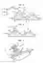 Fig. 02 - Forming a molded article using improved thermal-sprayed tooling