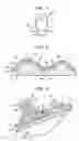 Fig. 03 - Forming a molded article using improved thermal-sprayed tooling