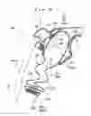 Fig. 23 - Head-protective airbag device