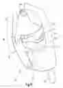 Fig. 09 - Crash-active headrest