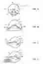Fig. 02 - Adaptable traction system of a vehicle