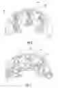 Fig. 05 - Bridge rectifier for charging system alternator