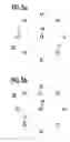 Fig. 06 - Lighting device and observation device