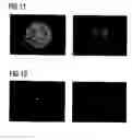 Fig. 09 - Lighting device and observation device